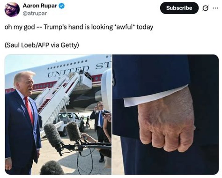 Aaron Rupar